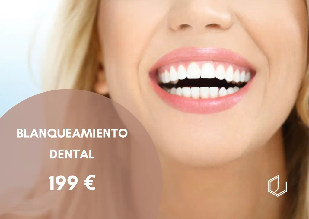 oferta blanqueamiento dental manresa a 199€